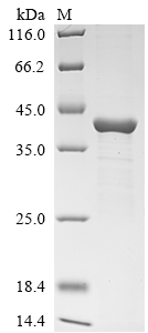 Pseudomonas aeruginosa Exotoxin A Protein
