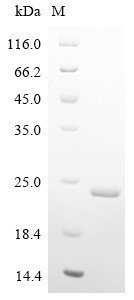 Human parainfluenza 2 virus Hemagglutinin-neuraminidase Protein