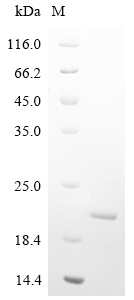 Human parainfluenza 1 virus Hemagglutinin-neuraminidase Protein