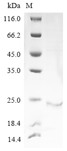 Human DDX60 Protein