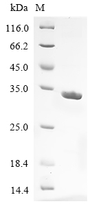 Human DDX60 Protein