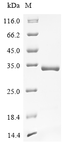 Rat Sod1 Protein