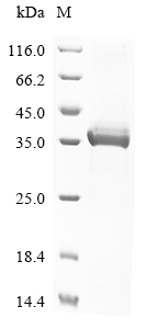 Mouse Enpp1 Protein