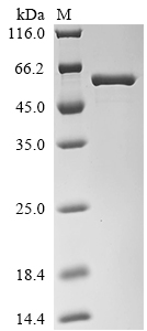Streptococcus pneumoniae serotype 4 Pneumolysin Protein