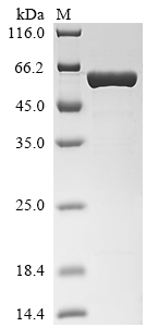 Human IRS1 Protein (Biotin)