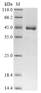 Unknown prokaryotic organism Phosphate-binding Protein