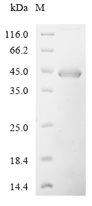 Human DHH Protein