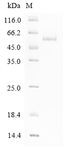 Human SMYD3 Protein