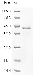 Human SPRY2 Protein