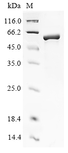 Human CMAHP Protein
