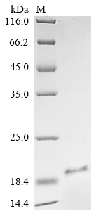 Mycobacteroides abscessus subsp. abscessus ESAT-6-like Protein