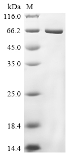 Gallus Chicken Lysozyme g Protein (Biotin)