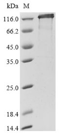Human NEDD4L Protein