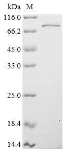 Human FUS Protein