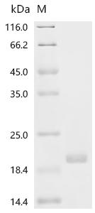 Human SFTA2 Protein