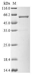 Human CT83 Protein (Biotin)