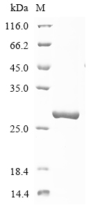 Human DDX60 Protein