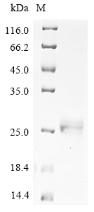 Human T273A Protein