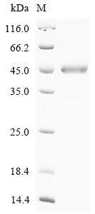 Human CAD Protein