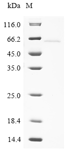 Human KRT24 Protein