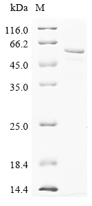 Human CYP3A5 Protein