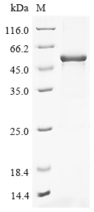 Human NOTUM Protein