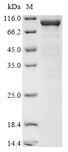 Human POLQ Protein