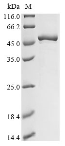 Human CAD Protein