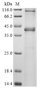 Human PHF6 Protein