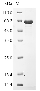 Porphyromonas gingivalis Lys-gingipain W83 Protein