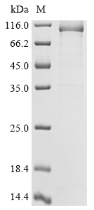 Human POLQ Protein