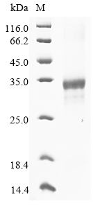 Mouse Rnaset2a Protein