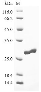 Fasciola hepatica Cathepsin L2 Protein