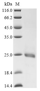 Human ADRB2 Protein
