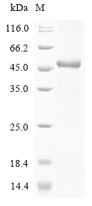 Human TRPV1 Protein