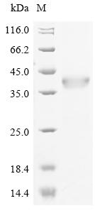 Human ITGAM Protein