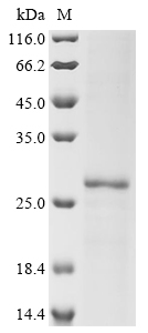 Human UPK2 Protein