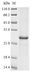 Human STEAP1B Protein