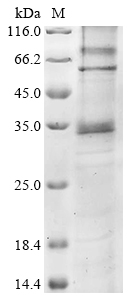 Human F2RL2 Protein