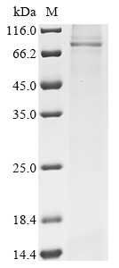 Human ABCD3 Protein