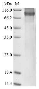Human ABCD2 Protein