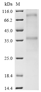 CCR8 Protein