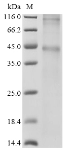 Human HTR1B Protein