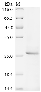 Avian infectious bronchitis virus Spike glycoprotein Protein