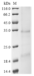 Mouse Nkg7 Protein