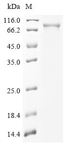 Human FOXN1 Protein