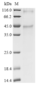 Human OPN1MW Protein