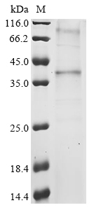 Human GPR15 Protein