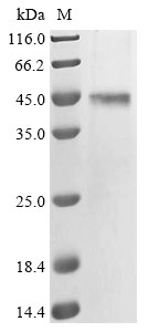 Human KCNJ16 Protein