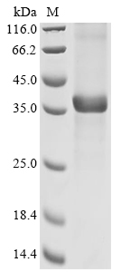 Human EPHX4 Protein